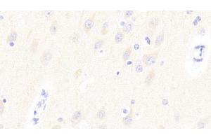 Detection of GP6 in Human Cerebrum Tissue using Polyclonal Antibody to Glycoprotein VI (GP6) (GP6 antibody  (AA 86-231))