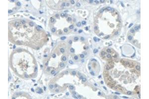 Detection of STAM2 in Human Kidney Tissue using Polyclonal Antibody to Signal Transducing Adaptor Molecule 2 (STAM2) (STAM2 antibody  (AA 1-377))
