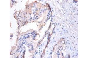 Immunohistochemistry of paraffin-embedded human prostate tissue using  at dilution of 1:100 (MMP7 antibody  (AA 95-267))