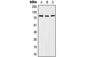 Western blot analysis of Anosmin expression in Jurkat (A), mouse heart (B), rat heart (C) whole cell lysates.