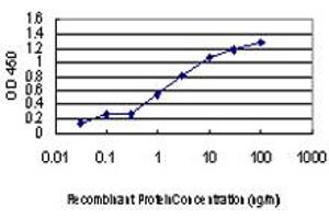Detection limit for recombinant GST tagged ULK1 is approximately 0. (ULK1 antibody  (AA 602-715))