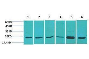 Western Blotting (WB) image for anti-Superoxide Dismutase 2, Mitochondrial (SOD2) antibody (ABIN3181553) (SOD2 antibody)