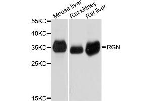 Western blot analysis of extracts of various cell lines, using RGN antibody (ABIN5995523) at 1/1000 dilution. (Regucalcin antibody)