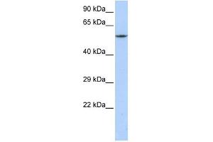 CACNB1 antibody used at 1 ug/ml to detect target protein. (CACNB1 antibody  (C-Term))