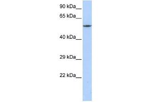 Western Blotting (WB) image for anti-Calcium Channel, Voltage-Dependent, beta 1 Subunit (CACNB1) (C-Term) antibody (ABIN633646)