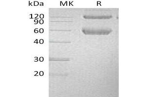 Western Blotting (WB) image for Bone Morphogenetic Protein Receptor 1A (BMPR1A) protein (His tag,Fc Tag) (ABIN7320751) (BMPR1A Protein (His tag,Fc Tag))