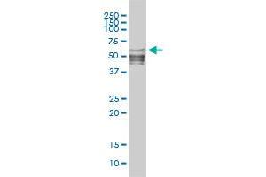 NFIC monoclonal antibody (M01), clone 1C12-2A2 Western Blot analysis of NFIC expression in A-431 . (NFIC antibody  (AA 1-428))