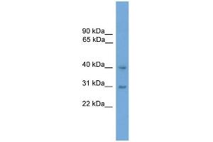 WB Suggested Anti-MAPK13 Antibody Titration: 0. (MAPK13 antibody  (Middle Region))