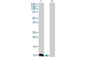 Western Blot analysis of CSTB expression in transfected 293T cell line by CSTB MaxPab polyclonal antibody. (CSTB antibody  (AA 1-98))