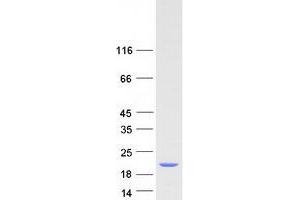 Validation with Western Blot (SF3B1 Protein (Transcript Variant 2) (Myc-DYKDDDDK Tag))