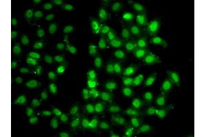 Immunofluorescence analysis of U20S cell using PSMD8 antibody.