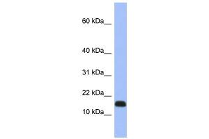 WB Suggested Anti-RPL37A Antibody Titration: 0. (RPL37A antibody  (Middle Region))