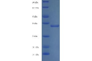 SDS-PAGE (SDS) image for Thioredoxin Domain Containing 12 (Endoplasmic Reticulum) (TXNDC12) (AA 27-172) protein (His-SUMO Tag) (ABIN5710570)