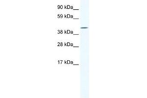 Western Blot showing IRX6 antibody used at a concentration of 1-2 ug/ml to detect its target protein. (IRX6 antibody  (C-Term))