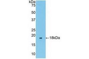 Detection of Recombinant BCL2L11, Human using Polyclonal Antibody to Bcl2 Like Protein 11 (BCL2L11) (BIM antibody  (AA 2-120))