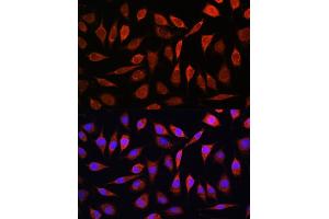 Immunofluorescence analysis of L929 cells using ZIP8 Rabbit pAb (ABIN6131079, ABIN6147995, ABIN6147996 and ABIN6214638) at dilution of 1:100. (SLC39A8 antibody  (AA 180-300))
