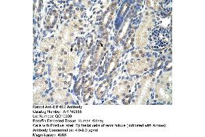 Rabbit Anti-EIF4E2 Antibody  Paraffin Embedded Tissue: Human Kidney Cellular Data: Epithelial cells of renal tubule Antibody Concentration: 4. (EIF4E2 antibody  (N-Term))