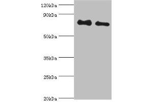 Western blot All lanes: Cytoplasmic tyrosine-protein kinase BMX antibody at 4 μg/mL Lane 1: A549 whole cell lysate Lane 2: Mouse heart tissue Secondary Goat polyclonal to rabbit IgG at 1/10000 dilution Predicted band size: 78 kDa Observed band size: 78 kDa (BMX antibody  (AA 65-280))