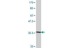 Western Blot detection against Immunogen (34. (MAGEA1 antibody  (AA 98-171))