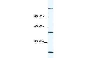 WB Suggested Anti-FGD1 Antibody Titration: 0. (FGD1 antibody  (C-Term))
