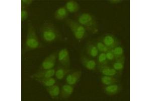 Immunofluorescent analysis of Hela cells fixed fixed by 4 % paraformaldehyde and using SIRT6 mouse mAb (dilution 1:100).