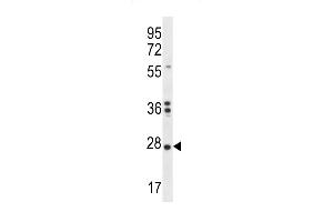 NKAIN1 Antibody (C-term) (ABIN656410 and ABIN2845704) western blot analysis in K562 cell line lysates (35 μg/lane). (NKAIN1 antibody  (C-Term))