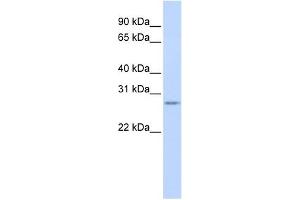 Vasohibin 1 antibody used at 1 ug/ml to detect target protein. (VASH1 antibody  (N-Term))