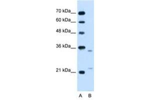 Image no. 1 for anti-Low Density Lipoprotein Receptor-Related Protein Associated Protein 1 (LRPAP1) (AA 258-307) antibody (ABIN205076) (LRPAP1 antibody  (AA 258-307))