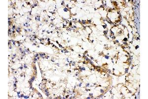IHC analysis of APOL1 using anti-APOL1 antibody (ABIN7600725). (APOL1 antibody  (AA 228-398))