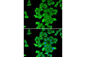 Immunofluorescence analysis of HeLa cell using SMYD2 antibody. (SMYD2A antibody)