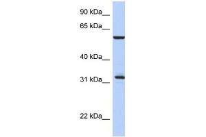 Western Blot showing CDC34 antibody used at a concentration of 1-2 ug/ml to detect its target protein. (CDC34 antibody  (Middle Region))