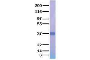 Validation with Western Blot (APOE Protein)