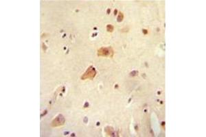 Formalin fixed, paraffin embedded human brain tissue stained with RICH2 Antibody (C-term) followed by peroxidase conjugation of the secondary antibody and DAB staining. (ARHGAP44 antibody  (C-Term))