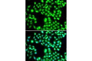 Immunofluorescence analysis of MCF-7 cells using YTHDC1 antibody (ABIN5974420). (YTHDC1 antibody)