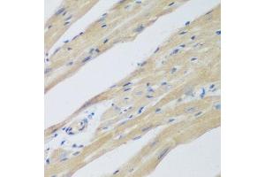 Immunohistochemistry of paraffin-embedded mouse heart using WDR77 antibody at dilution of 1:200 (40x lens). (WDR77 antibody)