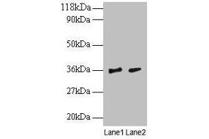 Western blot All lanes: SNRPG antibody at 2 μg/mL Lane 1: EC109 whole cell lysate Lane 2: 293T whole cell lysate Secondary Goat polyclonal to rabbit IgG at 1/15000 dilution Predicted band size: 9 kDa Observed band size: 36 kDa (SNRPG antibody  (AA 1-76))