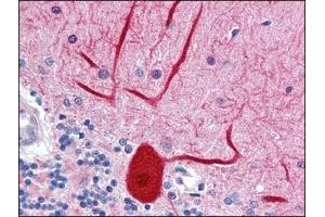 Human Brain, cerebellum: Formalin-Fixed, Paraffin-Embedded (FFPE) (ENPEP antibody  (Tyr182))