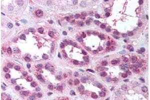 Human Kidney (formalin-fixed, paraffin-embedded) stained with RELA antibody ABIN218582 at 1:500 followed by biotinylated goat anti-rabbit IgG secondary antibody ABIN481713, alkaline phosphatase-streptavidin and chromogen. (NF-kB p65 antibody  (pSer529))