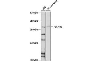 Western blot analysis of extracts of various cell lines, using PLXNB1 antibody (ABIN6129763, ABIN6145806, ABIN6145807 and ABIN6214109) at 1:1000 dilution.