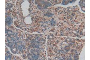 IHC-P analysis of Rat Pancreas Tissue, with DAB staining. (PROCR antibody  (AA 59-217))