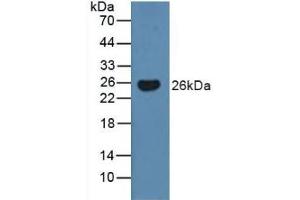 Detection of BMF in Human Serum using Polyclonal Antibody to Bcl2 Modifying Factor (BMF) (BMF antibody  (AA 1-181))