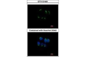 Image no. 3 for anti-Trefoil Factor 1 (TFF1) (AA 1-84) antibody (ABIN1501358) (TFF1 antibody  (AA 1-84))