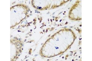 Immunohistochemistry of paraffin-embedded Human gastric using UBE3A Polyclonal Antibody at dilution of 1:200 (40x lens). (ube3a antibody)