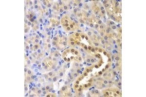 Immunohistochemistry of paraffin-embedded mouse kidney using GLO1 antibody at dilution of 1:200 (400x lens). (GLO1 antibody)