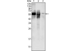 Western blot analysis using GPI mouse mAb against HepG2 (1) , SMMC-7721 (2) cell lysate and rat liver tissues lysate (3). (GPI antibody)
