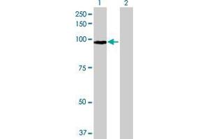 Western Blotting (WB) image for FBXO11 293T Cell Transient Overexpression Lysate(Denatured) (ABIN1337839)
