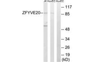 Western blot analysis of extracts from HuvEc/Jurkat cells, using ZFYVE20 Antibody.