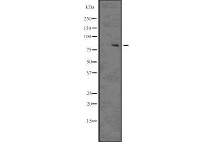 Western blot analysis of Phospho-DRP1 (Ser637) using 293 whole cell lysates (Dynamin 1-Like antibody  (pSer637))