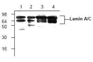 Image no. 1 for anti-Lamin A/C (LMNA) antibody (ABIN127068) (Lamin A/C antibody)