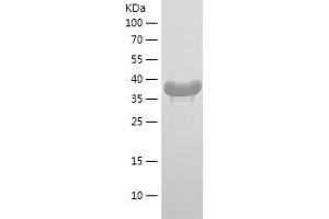 Western Blotting (WB) image for RNA Guanine-7 Methyltransferase (RNMT) (AA 31-126) protein (His-IF2DI Tag) (ABIN7282523) (RNMT Protein (AA 31-126) (His-IF2DI Tag))